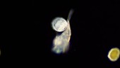 Keratella valga rotifer carrying eggs
