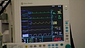Patient's vital signs during surgery