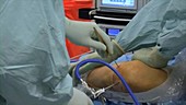 Knee arthroscopy