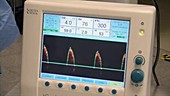 Oesophageal Doppler monitor ODM