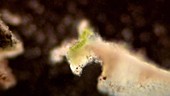 Chewing gum lichen, light microscopy