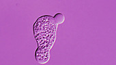 Entamoeba histolytica parasite