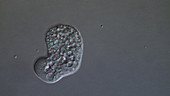 Entamoeba histolytica parasite