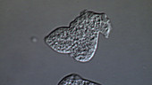 Entamoeba histolytica parasites