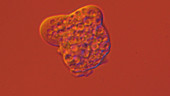 Entamoeba histolytica parasite