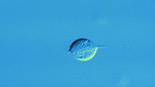 Trichomonas vaginalis parasite