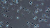 Leishmania aethiopica parasites