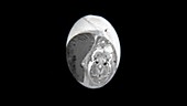 Chick hatching, MRI and animation