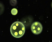Volvox, light micrograph