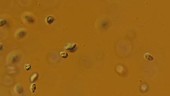 Ciliate protozoa swimming