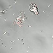 Human neutrophils, laser microscopy