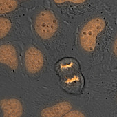 Cell division by mitosis, timelapse