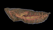 Butterfly chrysalis, CT scan