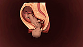 Childbirth, animation