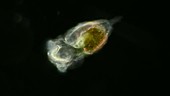 Predatory rotifer, light microscopy