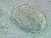 Beating cilia of a ciliate protozoan