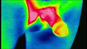 Male erection, thermogram footage