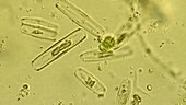 Rio Tinto diatoms, light microscopy