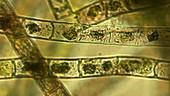 Rio Tinto algae, light microscopy