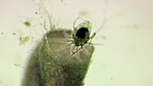 Bladderwort traps prey, light microscopy