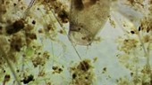 Bladderwort traps, light microscopy