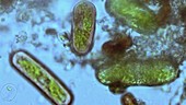 Ice microbes, light microscopy