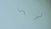 Ancylostoma hookworms, light microscopy