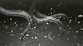 Ancylostoma hookworms, light microscopy