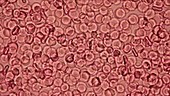 Red blood cells, light microscopy