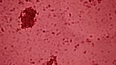 Red blood cells, light microscopy