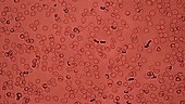 Red blood cells, light microscopy