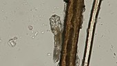 Hair mite, light microscopy