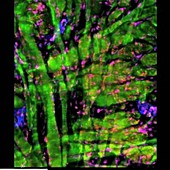 Skeletal muscle, fluorescence microscopy