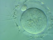 Sperm cells surrounding an egg