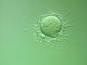 Sperm cells surrounding an egg