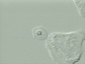Neutrophil ingesting a yeast cell