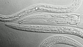 Nematode worms, light microscopy