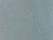 E. coli bacterial growth, light microscopy