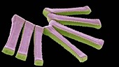 Colonial diatom Fragilaria, SEM