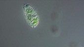 Ciliate protozoan Coleps sp