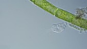 Collotheca rotifer, light microscopy
