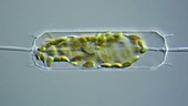 Ditylum diatoms, light microscopy