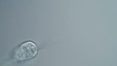 Collotheca rotifer, light microscopy