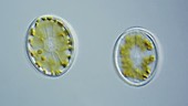 Cocconeis diatoms, light microscopy