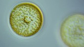 Coscinodiscus diatoms, light microscopy