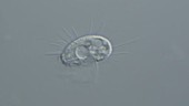 Cyclidium ciliate, light microscopy