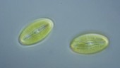 Diploneis diatoms, light microscopy