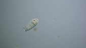 Enchelys ciliate, light microscopy