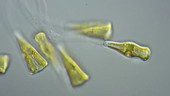 Gomphonema diatoms, light microscopy