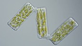 Grammatophora diatoms, light microscopy